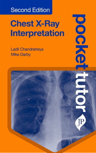 Pocket Tutor: Chest X-Ray Interpretation, 2nd Edition (Original PDF from Publisher)