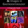 Clinical Challenges and Images in Gastroenterology: A Diagnostic Guide (Original PDF from Publisher)