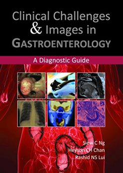 Clinical Challenges and Images in Gastroenterology: A Diagnostic Guide (Original PDF from Publisher)