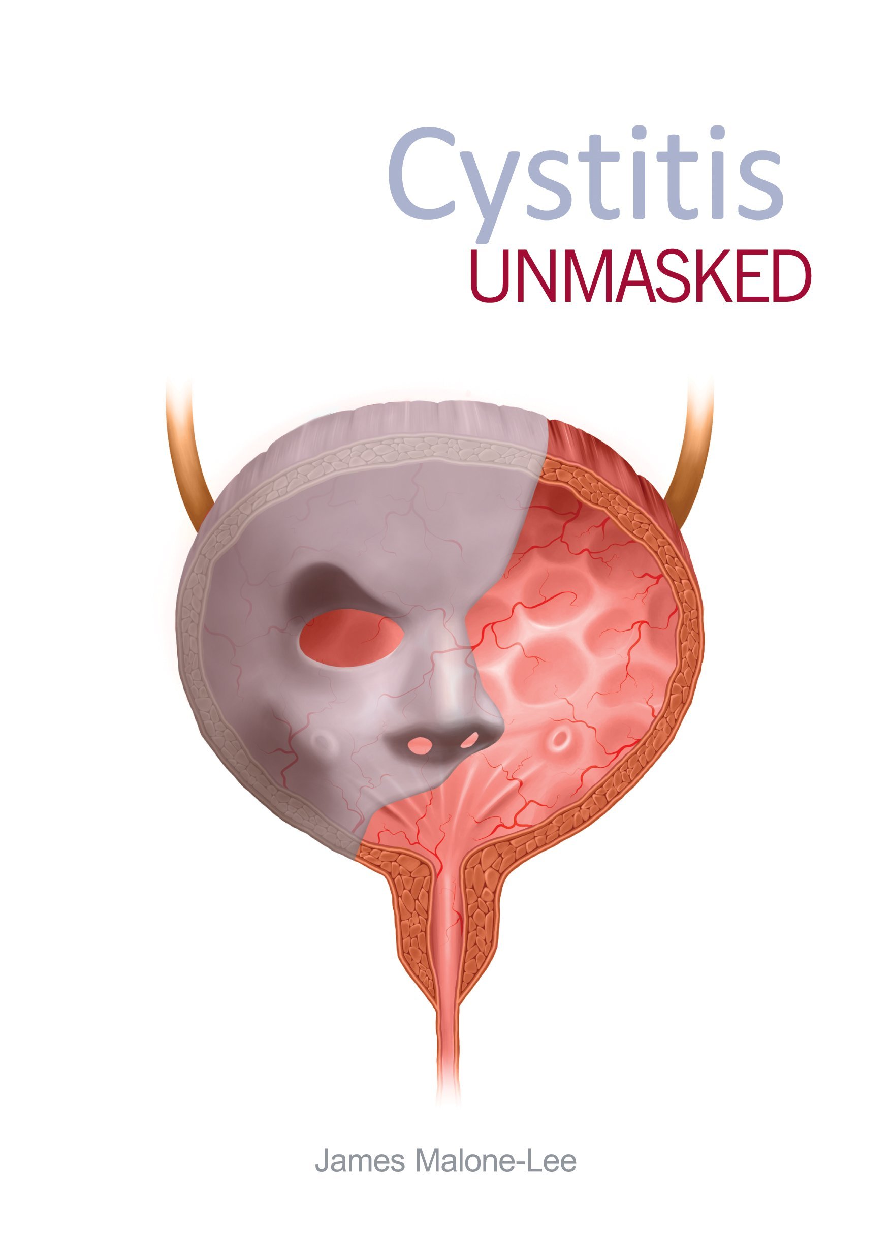 Cystitis unmasked (Original PDF from Publisher)