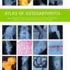 Atlas of Osteoarthritis