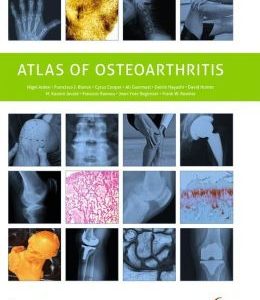Atlas of Osteoarthritis
