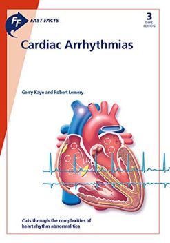 Fast Facts: Cardiac Arrhythmias (Original PDF from Publisher)
