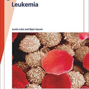 Fast Facts: Leukemia: From initial gene mutation to survivorship support (Original PDF from Publisher)