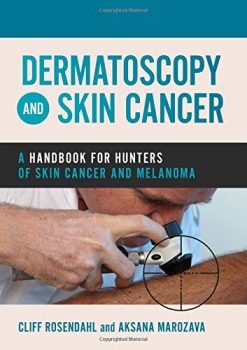 Dermatoscopy and Skin Cancer: A handbook for hunters of skin cancer and melanoma (Original PDF from Publisher)