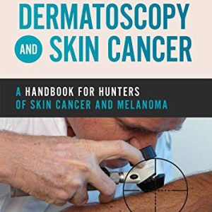 Dermatoscopy and Skin Cancer: A handbook for hunters of skin cancer and melanoma (Original PDF from Publisher)