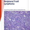 Fast Facts: Peripheral T-cell Lymphoma: Unraveling the complexities of diagnosis and management (Original PDF from Publisher)