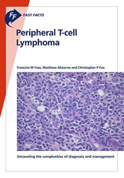 Fast Facts: Peripheral T-cell Lymphoma: Unraveling the complexities of diagnosis and management (Original PDF from Publisher)