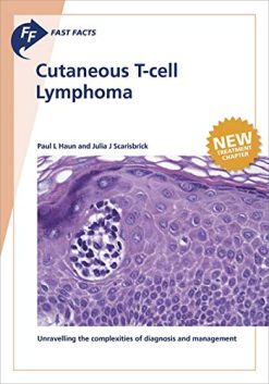 Fast Facts: Cutaneous T-cell Lymphoma (Original PDF from Publisher)