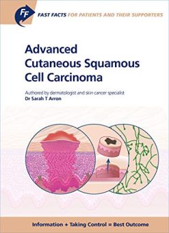 Fast Facts: Advanced Cutaneous Squamous Cell Carcinoma for Patients and their Supporters: Information + Taking Control = Best Outcome (Original PDF from Publisher)