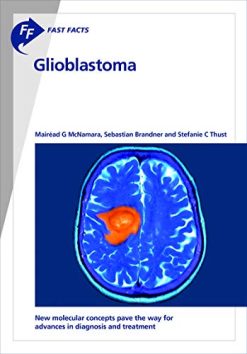 Fast Facts: Glioblastoma: New molecular concepts pave the way for advances in diagnosis and treatment (Original PDF from Publisher)