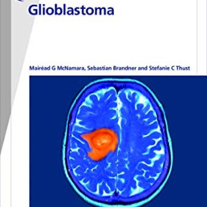 Fast Facts: Glioblastoma: New molecular concepts pave the way for advances in diagnosis and treatment (Original PDF from Publisher)