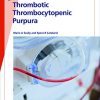 Fast Facts: Thrombotic Thrombocytopenic Purpura: Prompt action saves lives (Original PDF from Publisher)