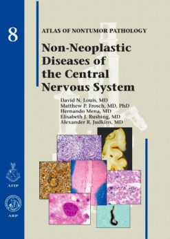 Non-Neoplastic Diseases of the Central Nervous System (Atlas of Nontumor Pathology, First Series Fascicle) (True PDF)
