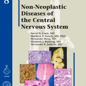 Non-Neoplastic Diseases of the Central Nervous System (Atlas of Nontumor Pathology, First Series Fascicle) (True PDF)