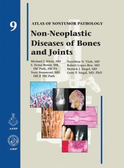 Non-Neoplastic Diseases of Bones and Joints (Atlas of Nontumor Pathology) (True PDF)