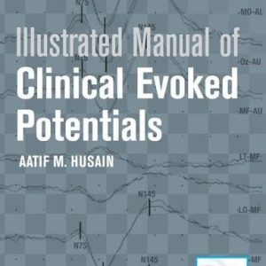 Illustrated Manual of Clinical Evoked Potentials (PDF)