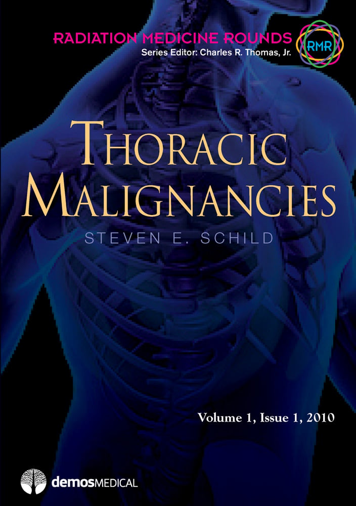 Thoracic Malignancies (EPUB)