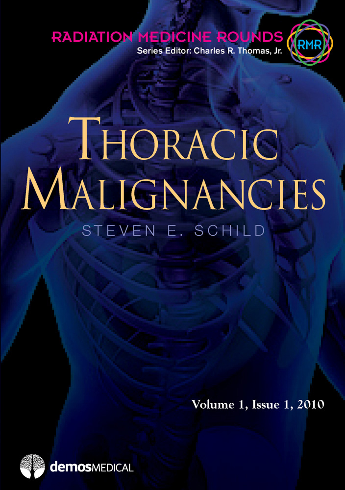 Thoracic Malignancies (Original PDF from Publisher)