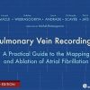 Pulmonary Vein Recordings: A Practical Guide to the Mapping and Ablation of Atrial Fibrillation