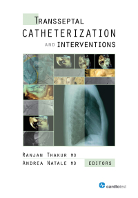 Transseptal Catheterization and Interventions (Original PDF from Publisher)