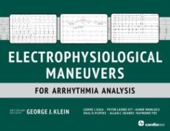 Electrophysiological Maneuvers for Arrhythmia Analysis (ORIGINAL PDF from Publisher)