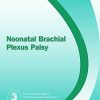 Neonatal Brachial Plexus Palsy (ePub)