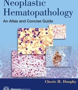 Neoplastic Hematopathology: An Atlas and Concise Guide