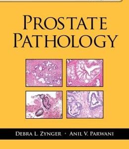 Prostate Pathology