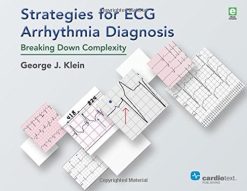 Strategies for ECG Arrhythmia Diagnosis: Breaking Down Complexity (PDF)