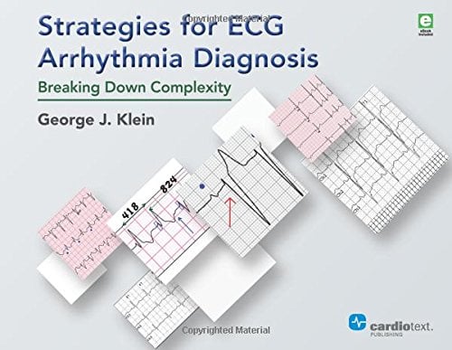 Strategies for ECG Arrhythmia Diagnosis: Breaking Down Complexity (PDF)