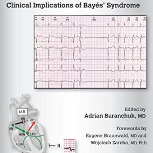 Interatrial Block and Supraventricular Arrhythmias: Clinical Implications of Bayes’ Syndrome (Original PDF from Publisher)