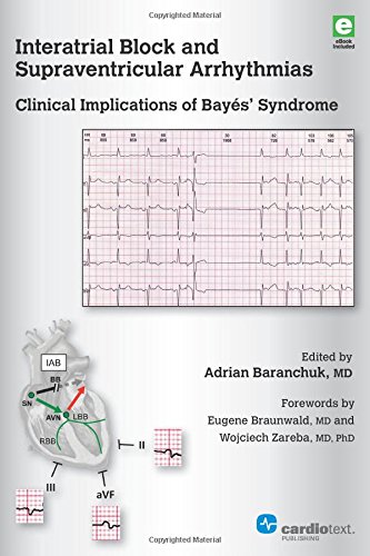 Interatrial Block and Supraventricular Arrhythmias: Clinical Implications of Bayes’ Syndrome (Original PDF from Publisher)