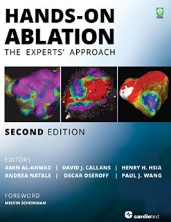 Hands-On Ablation: The Experts’ Approach, 2nd Edition (Original PDF from Publisher)