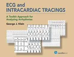 ECG and Intracardiac Tracings: A Toolkit Approach for Analyzing Arrhythmias (HQ PDF)