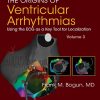 The Origins of Ventricular Arrhythmias: Using the ECG as a Key Tool for Localization, Volume 3 (EPUB)