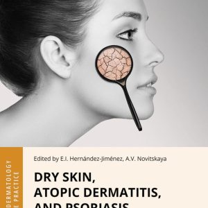 Dry Skin, Atopic Dermatitis, and Psoriasis in Cosmetic Dermatology & Skincare Practice (EPUB)