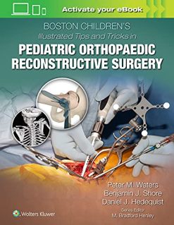Boston Children’s Illustrated Tips and Tricks in Pediatric Orthopaedic Reconstructive Surgery (ePub3+Converted PDF)