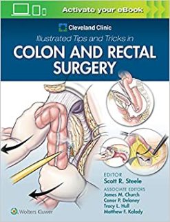 Cleveland Clinic Illustrated Tips and Tricks in Colon and Rectal Surgery (Original PDF from Publisher)