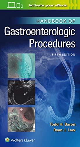 Handbook of Gastroenterologic Procedures (Lippincott Williams & Wilkins Handbook Series), 5th Edition (EPUB)