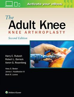 The Adult Knee, 2nd Edition (EPUB)