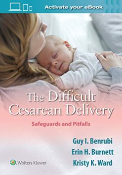 The Difficult Cesarean Delivery: Safeguards and Pitfalls (EPUB)