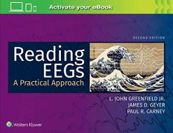 Reading EEGs: A Practical Approach, 2ed (ePub)
