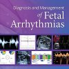 Diagnosis and Management of Fetal Arrhythmias (ePub)
