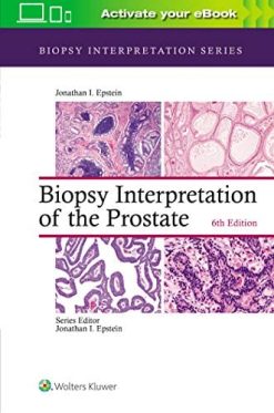 Biopsy Interpretation of the Prostate (Biopsy Interpretation Series), 6th Edition (EPUB)