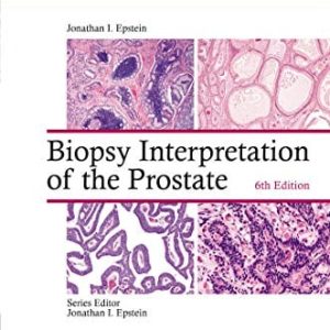 Biopsy Interpretation of the Prostate (Biopsy Interpretation Series), 6th Edition (EPUB)