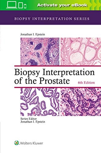 Biopsy Interpretation of the Prostate (Biopsy Interpretation Series), 6th Edition (EPUB)
