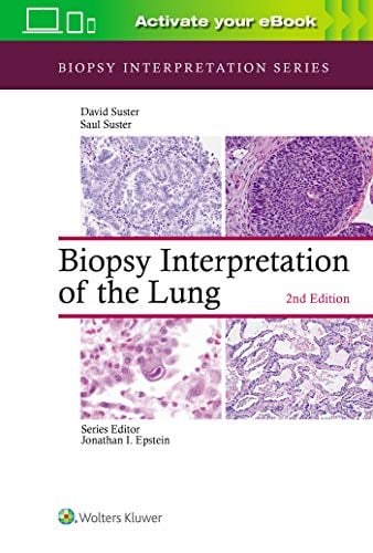 Biopsy Interpretation of the Lung, 2ed (Biopsy Interpretation Series) (ePub)