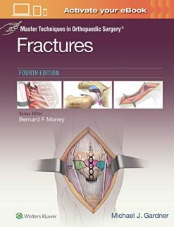 Master Techniques in Orthopaedic Surgery: Fractures, 4ed (ePub+Converted PDF)