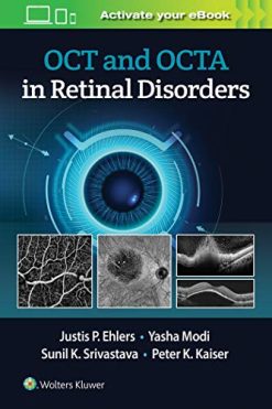 OCT and OCT Angiography in Retinal Disorders (ePub)